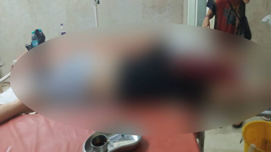 Bullet in the Dark: Woman Shot in Knee as Assam Rifles Clash With Militants Near Namsai's Reserve Forest